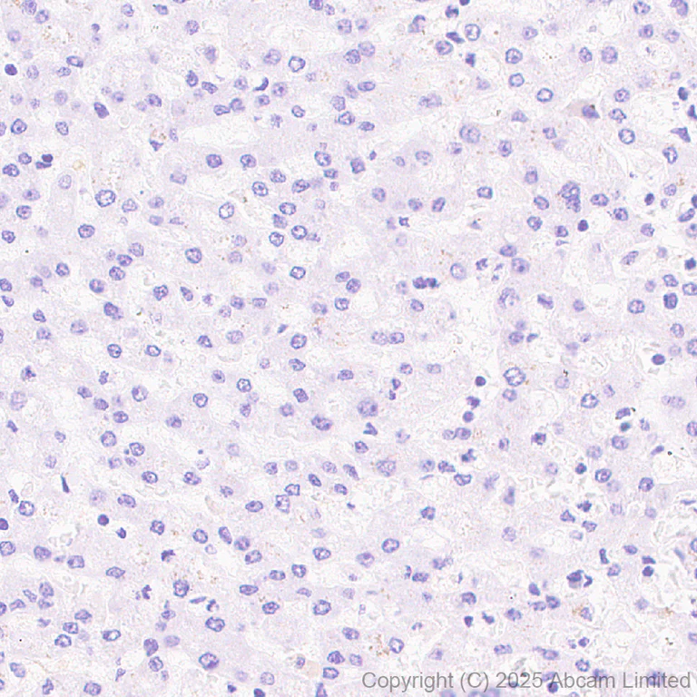 Immunohistochemistry (Formalin/PFA-fixed paraffin-embedded sections) - Anti-SCRN1 antibody [EPR29587-538] (AB323711)
