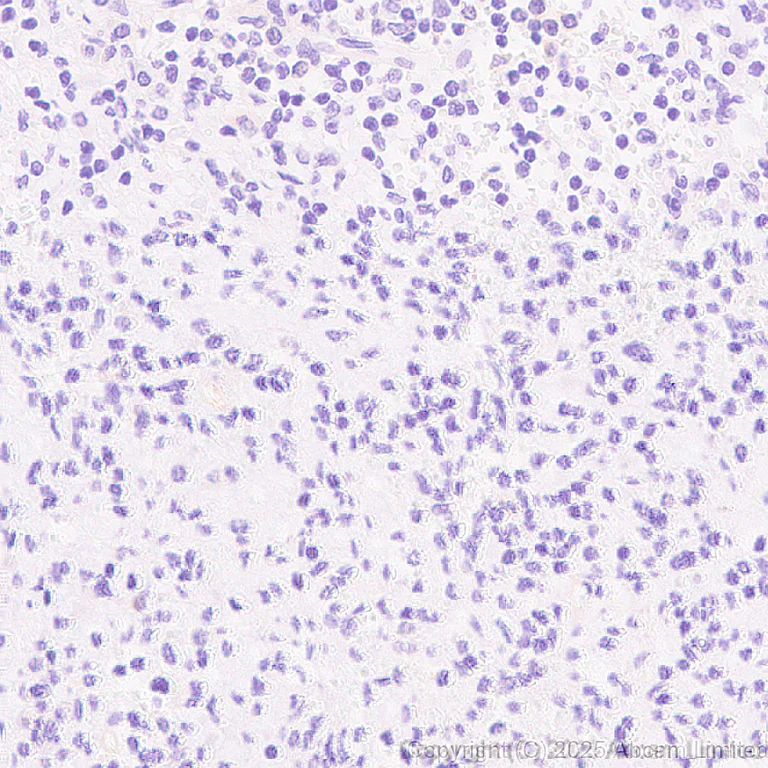 Immunohistochemistry (Formalin/PFA-fixed paraffin-embedded sections) - Anti-SCRN1 antibody [EPR29587-538] (AB323711)