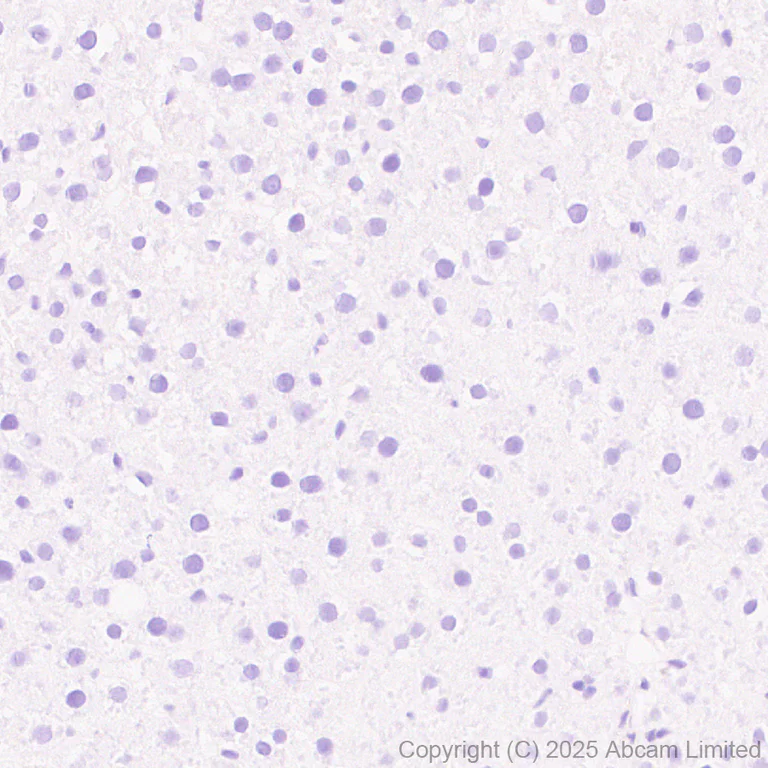 Immunohistochemistry (Formalin/PFA-fixed paraffin-embedded sections) - Anti-SCRN1 antibody [EPR29587-538] (AB323711)