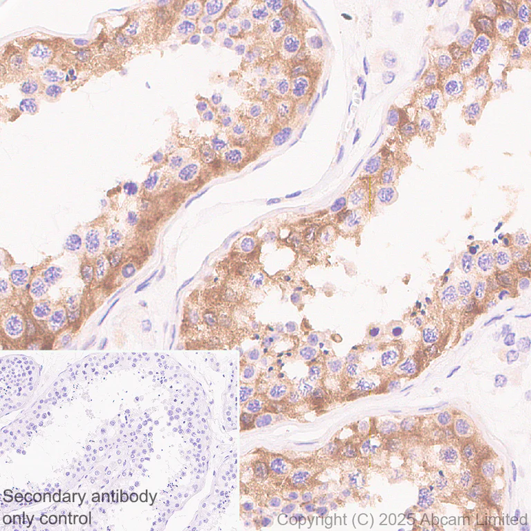 Immunohistochemistry (Formalin/PFA-fixed paraffin-embedded sections) - Anti-SCRN1 antibody [EPR29587-538] - BSA and Azide free (AB326078)