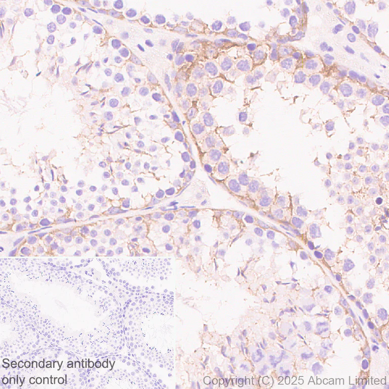 Immunohistochemistry (Formalin/PFA-fixed paraffin-embedded sections) - Anti-SCRN1 antibody [EPR29587-538] - BSA and Azide free (AB326078)