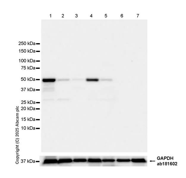 Western blot - Anti-SCRN1 antibody [EPR29587-538] - BSA and Azide free (AB326078)