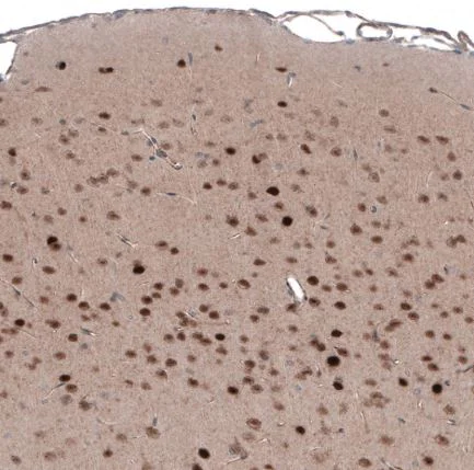 Immunohistochemistry (Formalin/PFA-fixed paraffin-embedded sections) - Anti-SCRT1 antibody (AB126331)