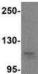 Western blot - Anti-SCUBE1 antibody (AB105358)