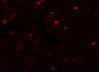 Immunocytochemistry/ Immunofluorescence - Anti-SCUBE2 antibody (AB105378)