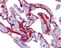 Immunohistochemistry (Formalin/PFA-fixed paraffin-embedded sections) - Anti-SCUBE2 antibody (AB117625)