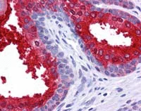 Immunohistochemistry (Formalin/PFA-fixed paraffin-embedded sections) - Anti-SCUBE2 antibody (AB117625)