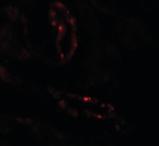 Immunohistochemistry (Formalin/PFA-fixed paraffin-embedded sections) - Anti-SCUBE3 antibody (AB189955), expandable thumbnail