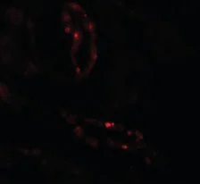 Immunohistochemistry (Formalin/PFA-fixed paraffin-embedded sections) - Anti-SCUBE3 antibody (AB189955)