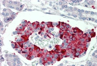 Immunohistochemistry (Formalin/PFA-fixed paraffin-embedded sections) - Anti-SCUBE3 antibody (AB189955), expandable thumbnail