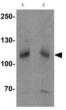 Western blot - Anti-SCUBE3 antibody (AB189955), expandable thumbnail