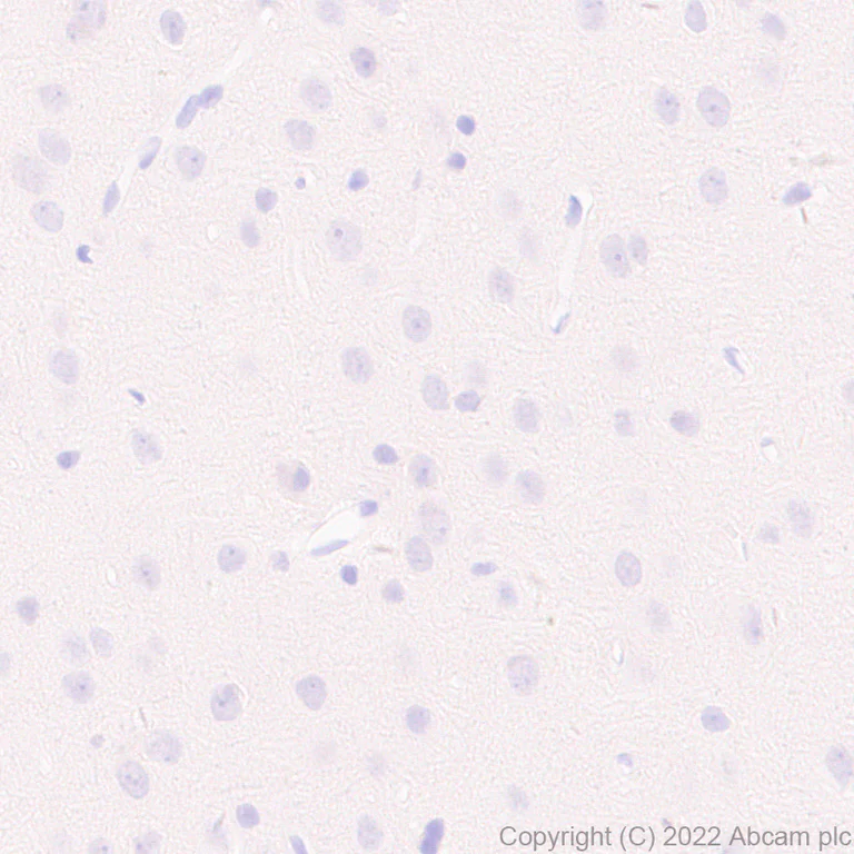 Immunohistochemistry (Formalin/PFA-fixed paraffin-embedded sections) - Anti-SCXA antibody [EPR26997-33] (AB307722)