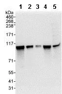 Western blot - Anti-SCYL1 antibody (AB95074)