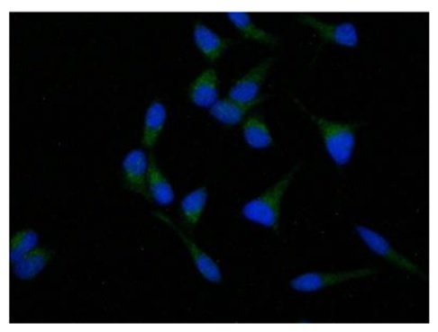 Immunocytochemistry/ Immunofluorescence - Anti-SCYL2 antibody (AB221195)