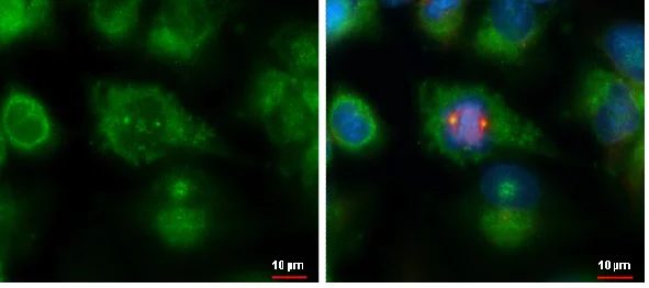 Immunocytochemistry/ Immunofluorescence - Anti-SDCCAG8 antibody (AB228891)