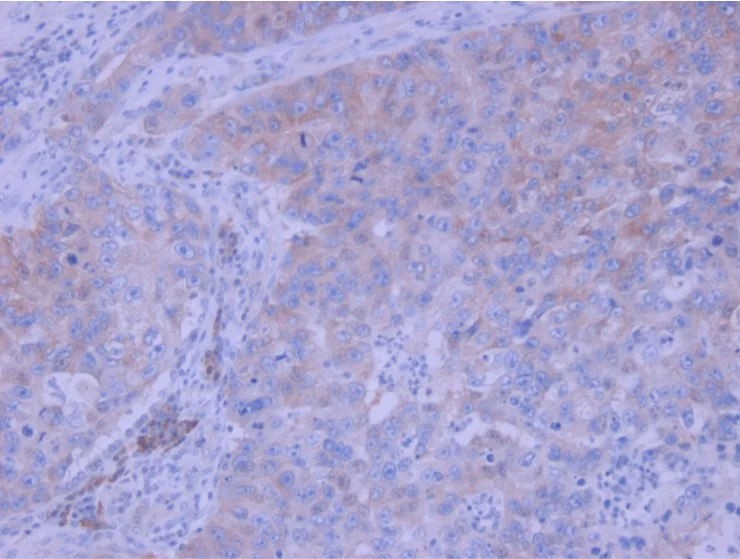 Immunohistochemistry (Formalin/PFA-fixed paraffin-embedded sections) - Anti-SDF1 antibody (AB9797)