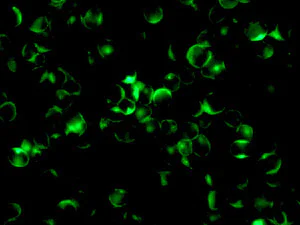 Immunocytochemistry/ Immunofluorescence - Anti-SDF1 antibody [EPR1216] (AB155090)