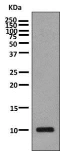 Western blot - Anti-SDF1 antibody [EPR1216] (AB155090)