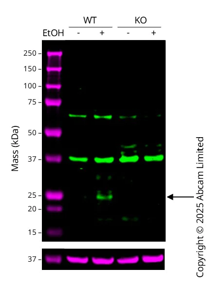 Western blot - Anti-SDF1 antibody [EPR1216] (AB155090)