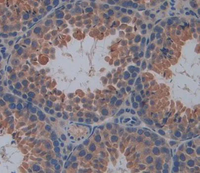 Immunohistochemistry (Formalin/PFA-fixed paraffin-embedded sections) - Anti-SDF2L1 antibody (AB231797)