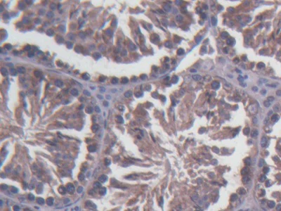 Immunohistochemistry (Formalin/PFA-fixed paraffin-embedded sections) - Anti-SDF2L1 antibody (AB231797)