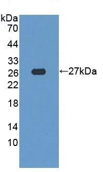 Western blot - Anti-SDF2L1 antibody (AB231797)