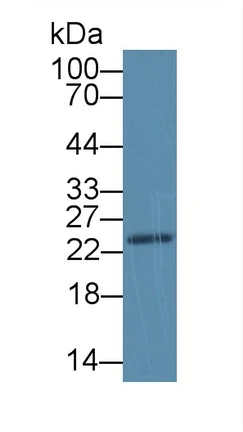 Western blot - Anti-SDF2L1 antibody (AB231797)