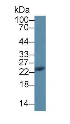 Western blot - Anti-SDF2L1 antibody (AB231797)