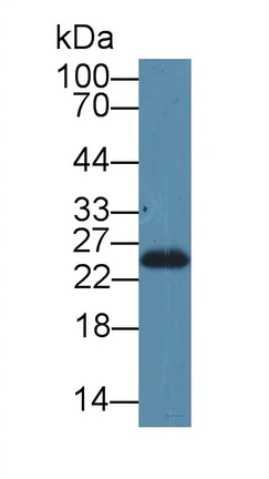 Western blot - Anti-SDF2L1 antibody (AB231797)