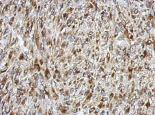 Immunohistochemistry (Formalin/PFA-fixed paraffin-embedded sections) - Anti-SDF4 antibody (AB154283)