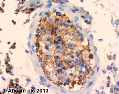 Immunohistochemistry (Formalin/PFA-fixed paraffin-embedded sections) - Anti-SDHA antibody [2E3GC12FB2AE2] (AB14715)