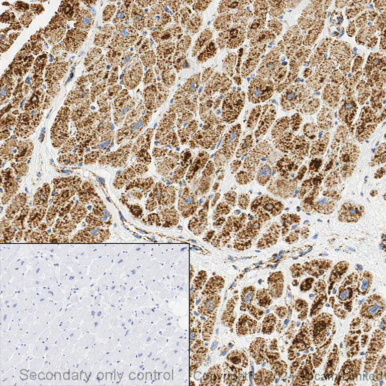 Immunohistochemistry (Formalin/PFA-fixed paraffin-embedded sections) - Anti-SDHA antibody [2E3GC12FB2AE2] (AB14715)