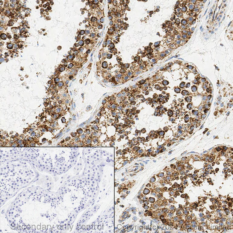 Immunohistochemistry (Formalin/PFA-fixed paraffin-embedded sections) - Anti-SDHA antibody [2E3GC12FB2AE2] (AB14715)
