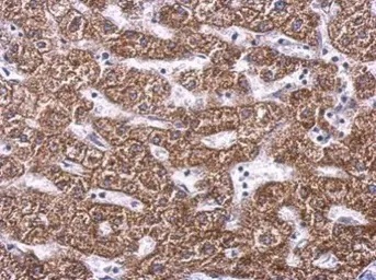 Immunohistochemistry (Formalin/PFA-fixed paraffin-embedded sections) - Anti-SDHA antibody (AB137756)