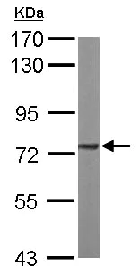 Western blot - Anti-SDHA antibody (AB137756)