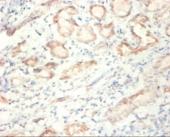 Immunohistochemistry (Formalin/PFA-fixed paraffin-embedded sections) - Anti-SDHA antibody (AB235594), expandable thumbnail
