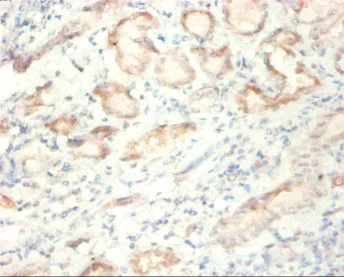 Immunohistochemistry (Formalin/PFA-fixed paraffin-embedded sections) - Anti-SDHA antibody (AB235594)