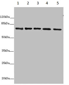 Western blot - Anti-SDHA antibody (AB235594), expandable thumbnail