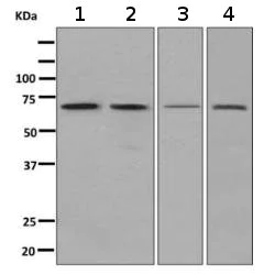 Western blot - Anti-SDHA antibody [EPR9042(B)] (AB139181)