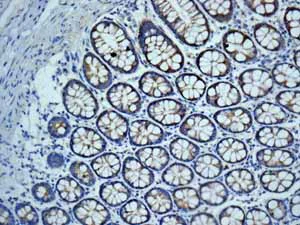 Immunohistochemistry (Formalin/PFA-fixed paraffin-embedded sections) - Anti-SDHA antibody [EPR9042(B)] - BSA and Azide free (AB248864)