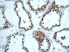 Immunohistochemistry (Formalin/PFA-fixed paraffin-embedded sections) - Anti-SDHA antibody [EPR9042(B)] - BSA and Azide free (AB248864)