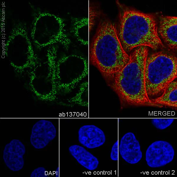 Immunocytochemistry/ Immunofluorescence - Anti-SDHA antibody [EPR9043(B)] (AB137040)