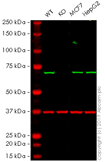 Western blot - Anti-SDHA antibody [EPR9043(B)] (AB137040), expandable thumbnail