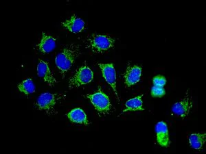 Immunocytochemistry/ Immunofluorescence - Anti-SDHA antibody [EPR9043(B)] - BSA and Azide free (AB240098)