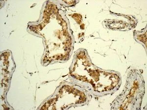 Immunohistochemistry (Formalin/PFA-fixed paraffin-embedded sections) - Anti-SDHA antibody [EPR9043(B)] - BSA and Azide free (AB240098)