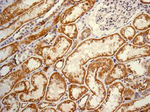 Immunohistochemistry (Formalin/PFA-fixed paraffin-embedded sections) - Anti-SDHA antibody [EPR9043(B)] - BSA and Azide free (AB240098)