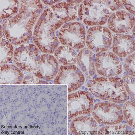 Immunohistochemistry (Formalin/PFA-fixed paraffin-embedded sections) - Anti-SDHA antibody [EPR9043(B)] - BSA and Azide free (AB240098), expandable thumbnail
