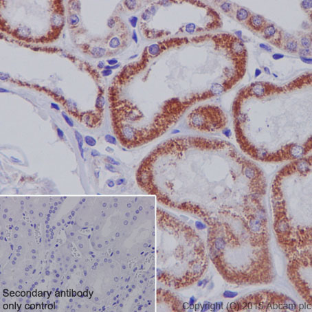 Immunohistochemistry (Formalin/PFA-fixed paraffin-embedded sections) - Anti-SDHA antibody [EPR9043(B)] - BSA and Azide free (AB240098), expandable thumbnail