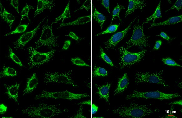 Immunocytochemistry/ Immunofluorescence - Anti-SDHA antibody [HL1117] (ab308379), expandable thumbnail