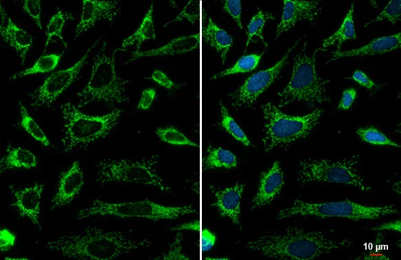 Immunocytochemistry/ Immunofluorescence - Anti-SDHA antibody [HL1117] (AB308379)